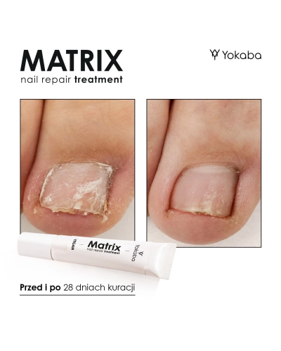 Matrix Nail Repair Treatment Vegan, 15ml